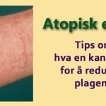 Middelhavskosthold - kjøtt 6 Atopisk eksem. Tips om hva du kan gjøre. Www. Johnsteffensen. No